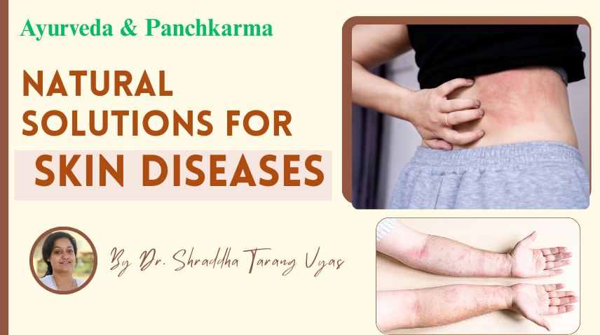 Ayurveda and Panchkarma: Natural Solutions for Skin Diseases & Holistic Skin Care