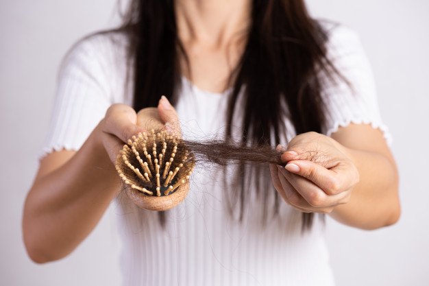hair-loss1